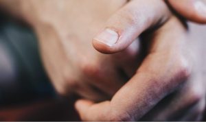 Attenzione a questi segni sulle mani